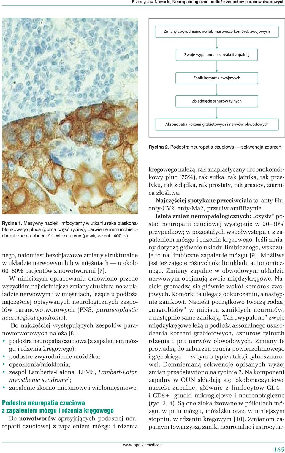 zmiany strukturalne w układzie nerwowym lub w mięśniach u około 60 80% pacjentów z nowotworami [7].