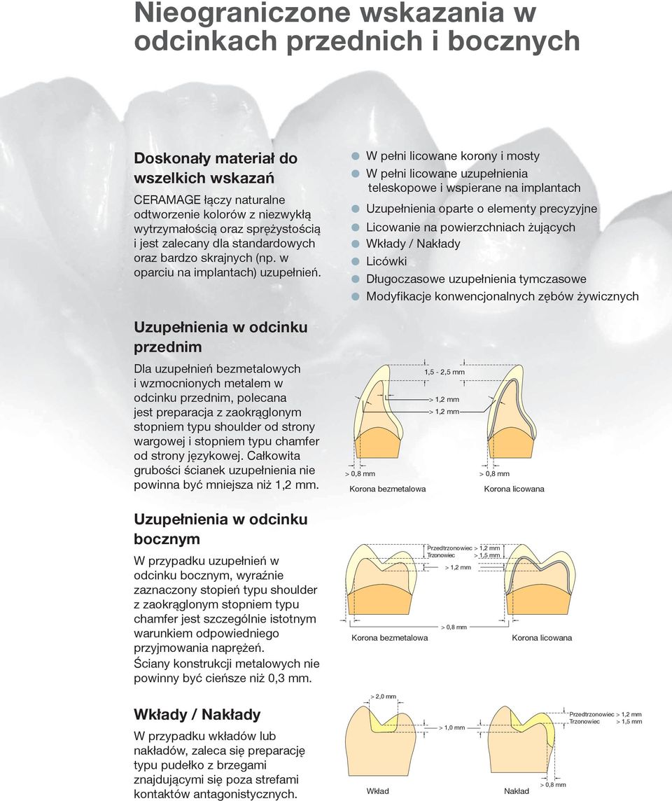 W pełni licowane korony i mosty W pełni licowane uzupełnienia teleskopowe i wspierane na implantach Uzupełnienia oparte o elementy precyzyjne Licowanie na powierzchniach żujących Wkłady / Nakłady