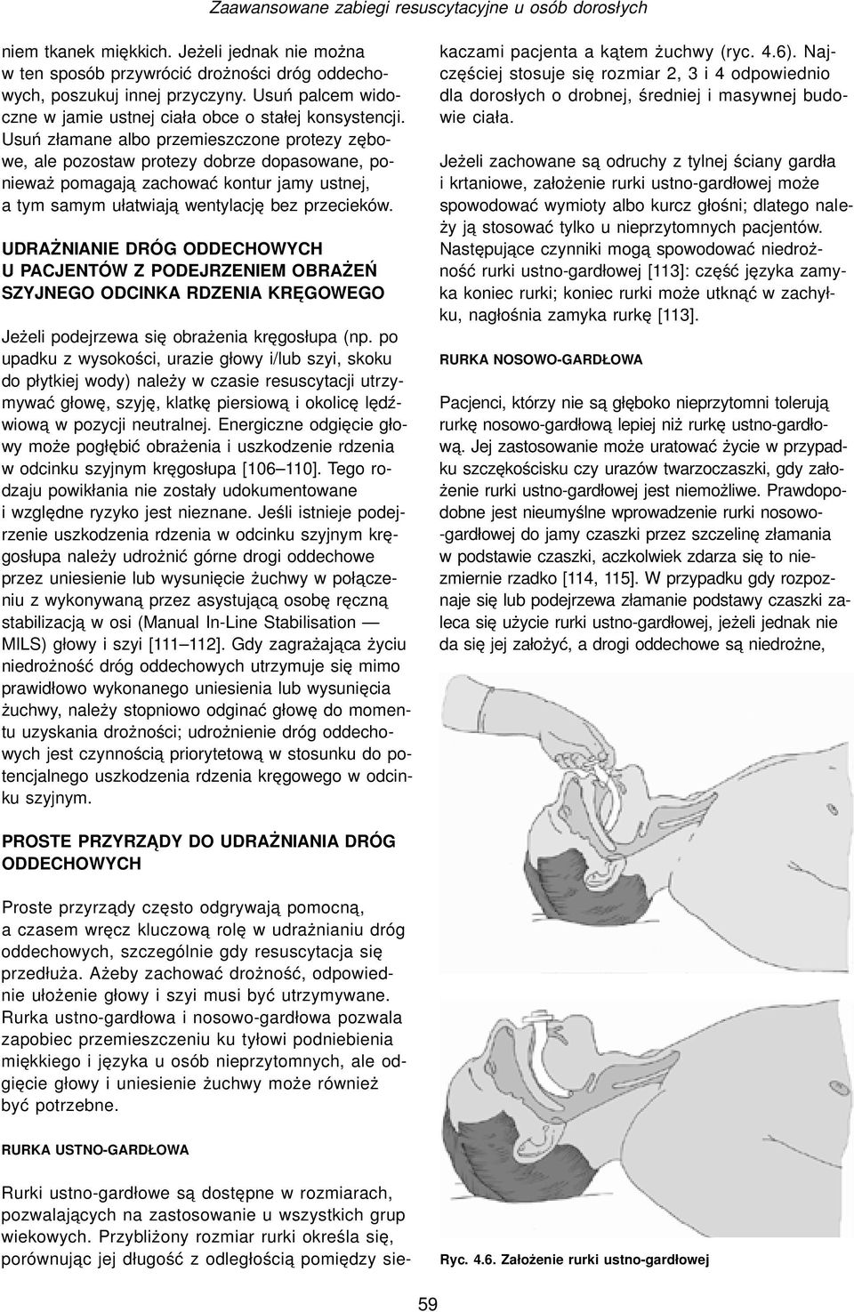 Usuń złamane albo przemieszczone protezy zębowe, ale pozostaw protezy dobrze dopasowane, ponieważ pomagaja zachować kontur jamy ustnej, a tym samym ułatwiaja wentylację bez przecieków.