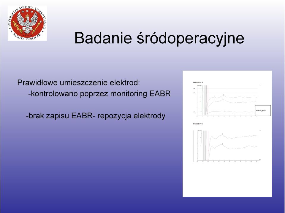 -kontrolowano poprzez monitoring