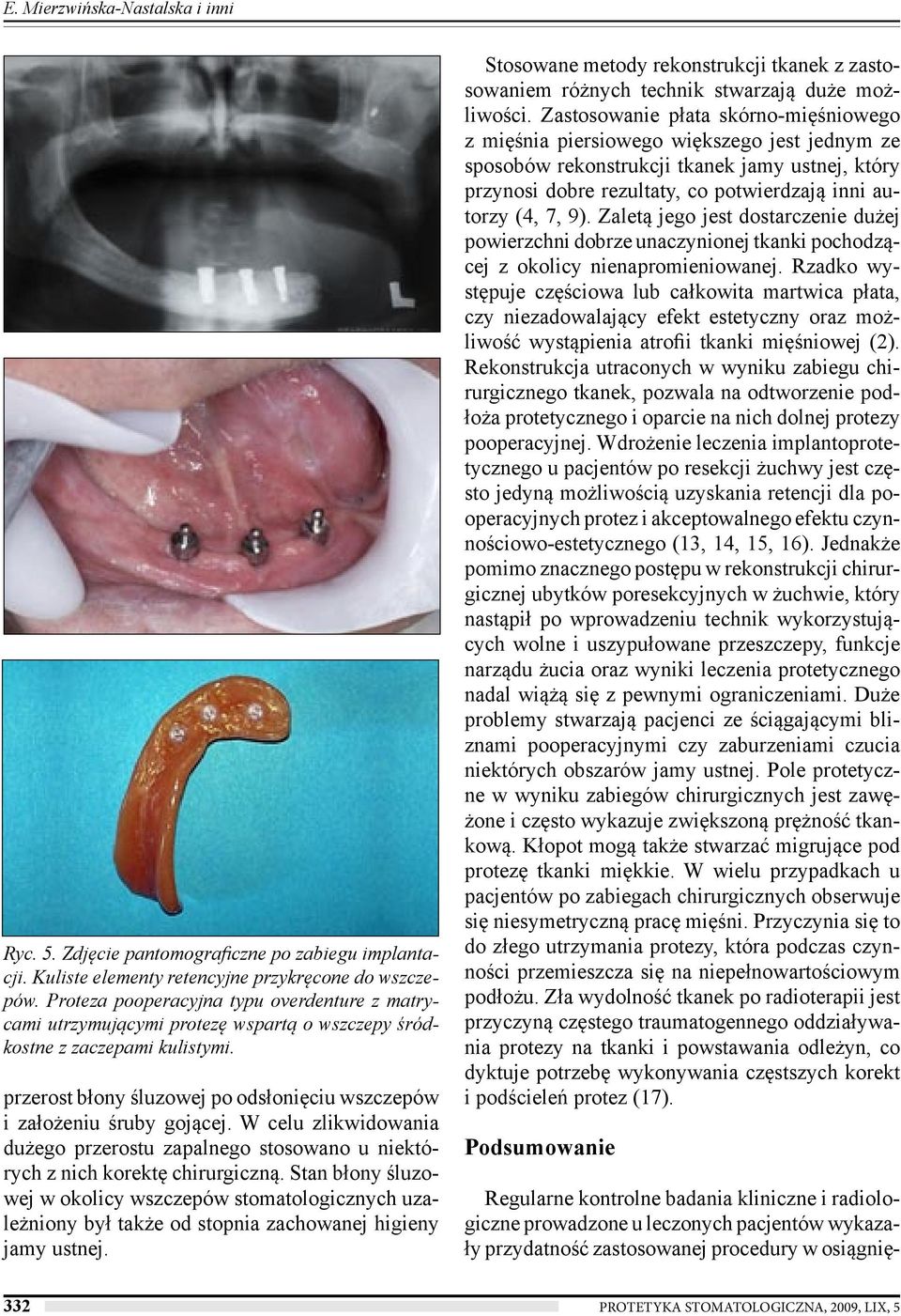 W celu zlikwidowania dużego przerostu zapalnego stosowano u niektórych z nich korektę chirurgiczną.