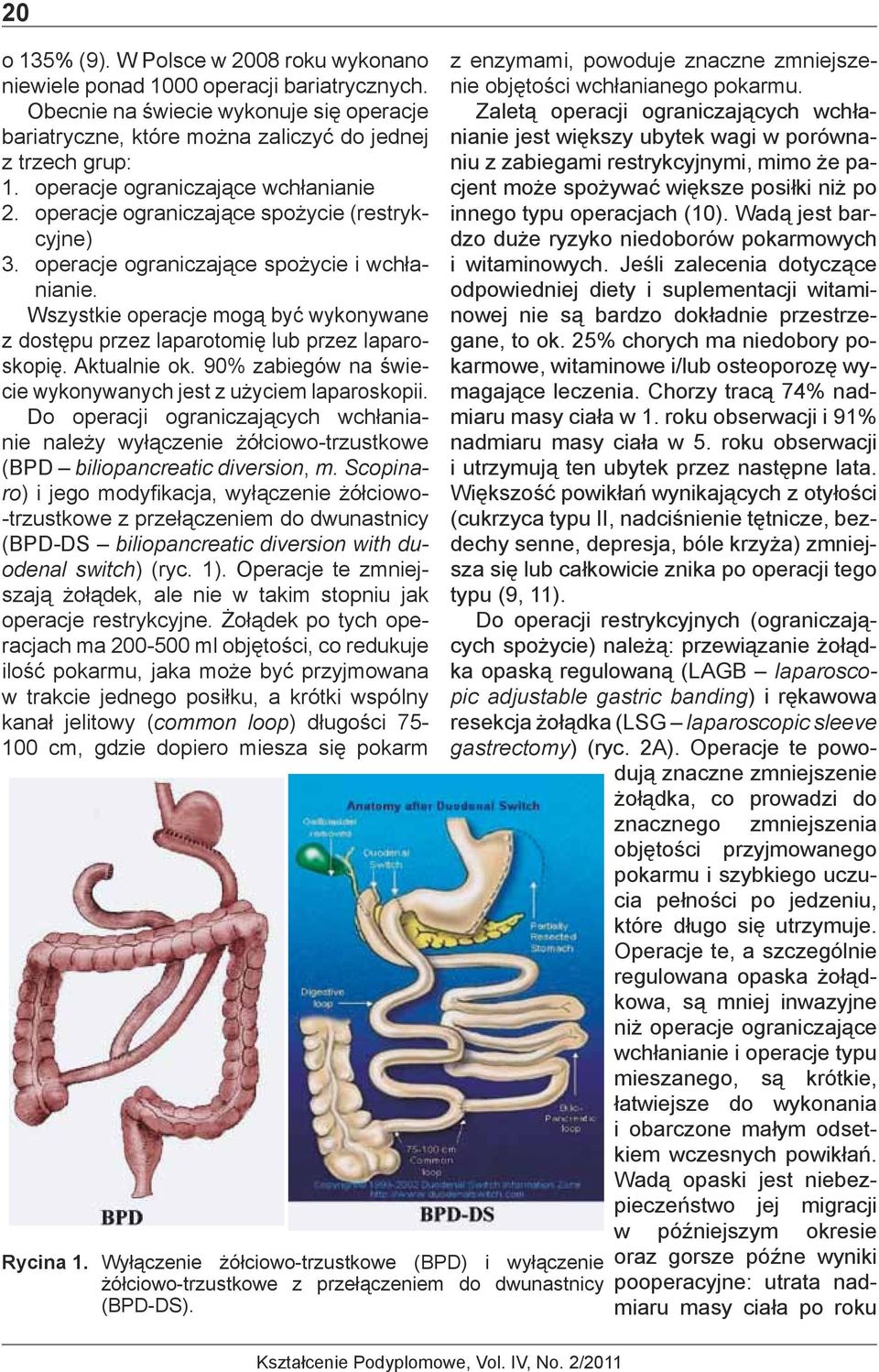 Wszystkie operacje mogą być wykonywane z dostępu przez laparotomię lub przez laparoskopię. Aktualnie ok. 90% zabiegów na świecie wykonywanych jest z użyciem laparoskopii.