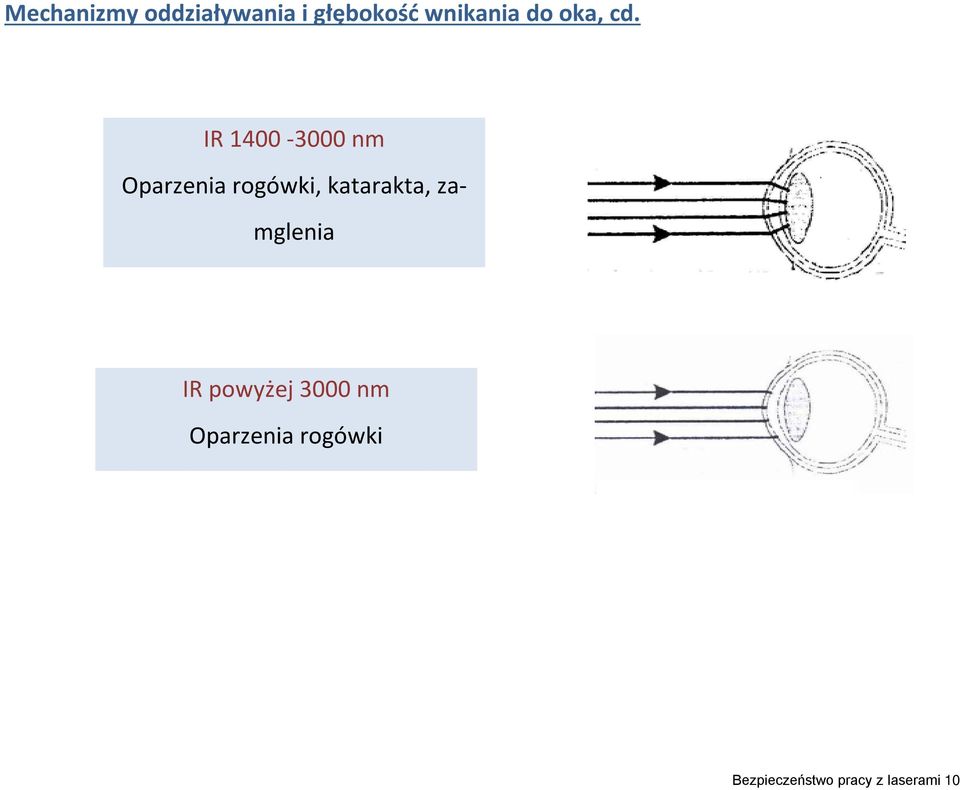 IR 1400-3000 nm Oparzenia rogówki, katarakta,
