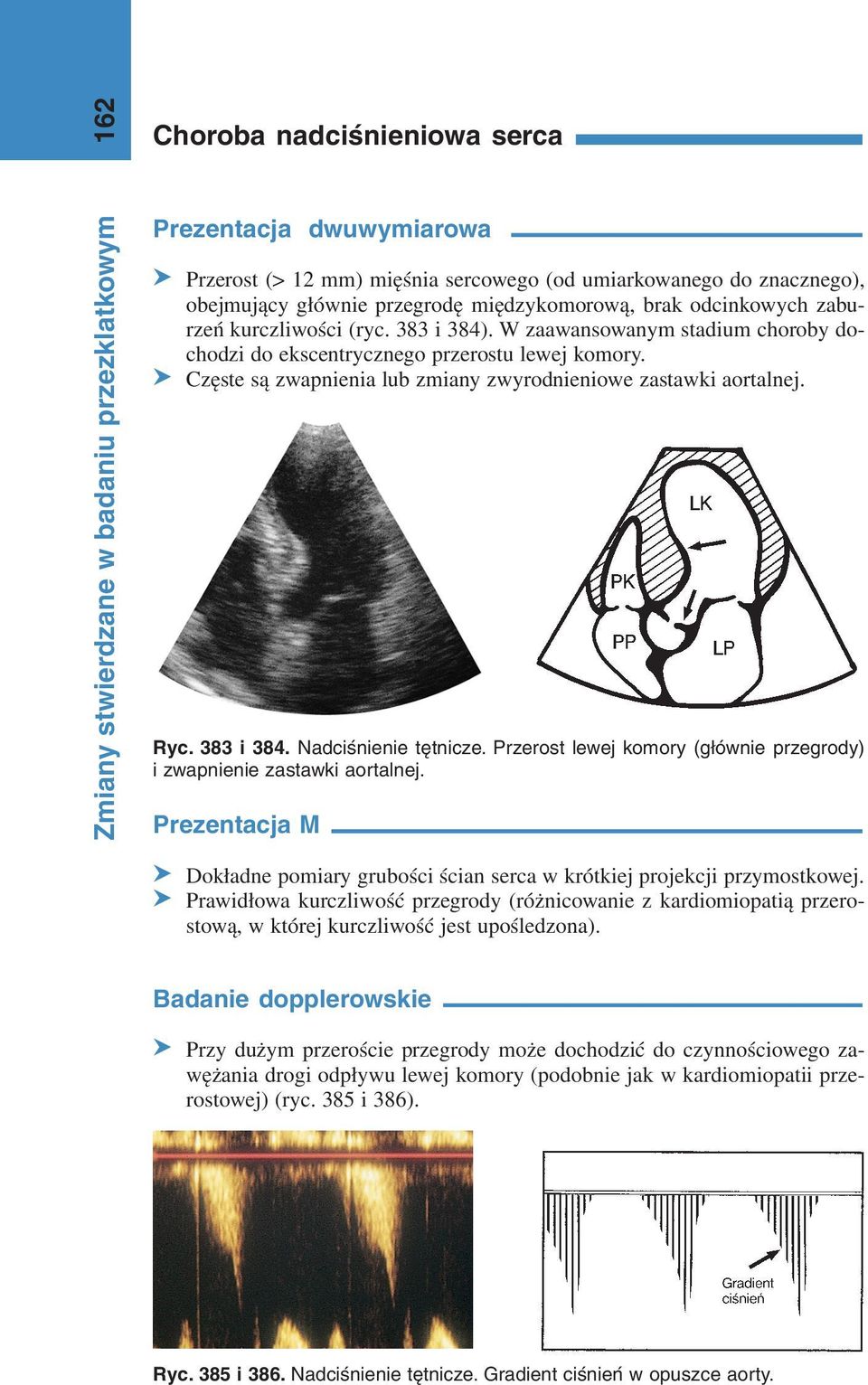 383 i 384. Nadciśnienie tętnicze. Przerost lewej komory (głównie przegrody) i zwapnienie zastawki aortalnej. Prezentacja M S Dokładne pomiary grubości ścian serca w krótkiej projekcji przymostkowej.