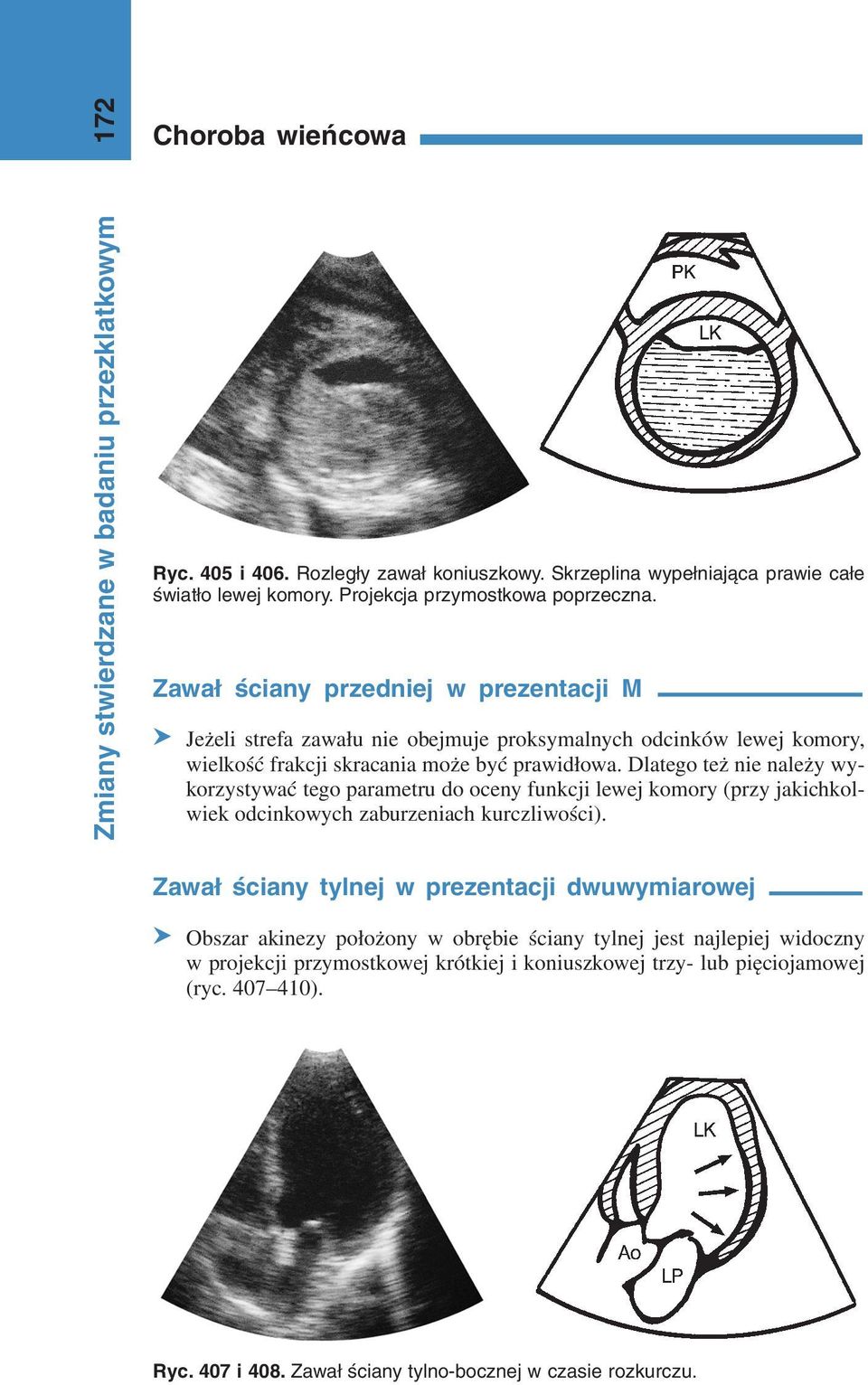 Dlatego też nie należy wykorzystywać tego parametru do oceny funkcji lewej komory (przy jakichkolwiek odcinkowych zaburzeniach kurczliwości).