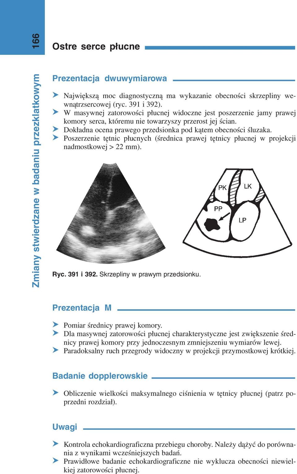 S Poszerzenie tętnic płucnych (średnica prawej tętnicy płucnej w projekcji nadmostkowej > 22 mm). Ryc. 391 i 392. Skrzepliny w prawym przedsionku. Prezentacja M S Pomiar średnicy prawej komory.