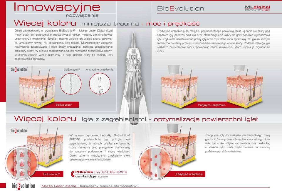 podczas wychodzenia urazy skóry i krwawienie. Szybkie i mocne wejście igły w głąb skóry, sprawia, igły.