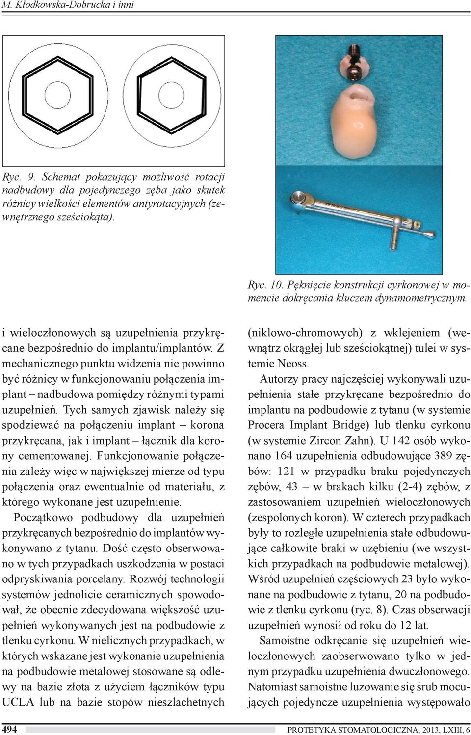 Z mechanicznego punktu widzenia nie powinno być różnicy w funkcjonowaniu połączenia implant nadbudowa pomiędzy różnymi typami uzupełnień.