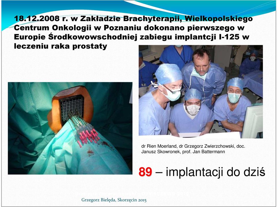 pierwszego w Europie Środkowowschodniej zabiegu implantcji I-125 w leczeniu raka