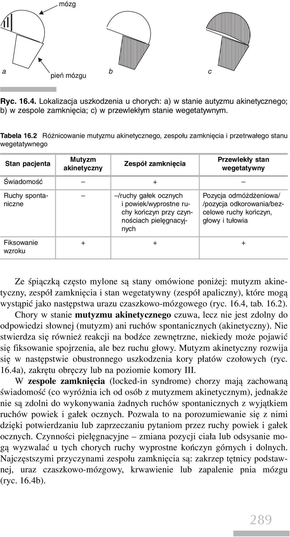 spontaniczne /ruchy gałek ocznych i powiek/wyprostne ruchy kończyn przy czynnościach pielęgnacyjnych Pozycja odmóżdżeniowa/ /pozycja odkorowania/bezcelowe ruchy kończyn, głowy i tułowia Fiksowanie