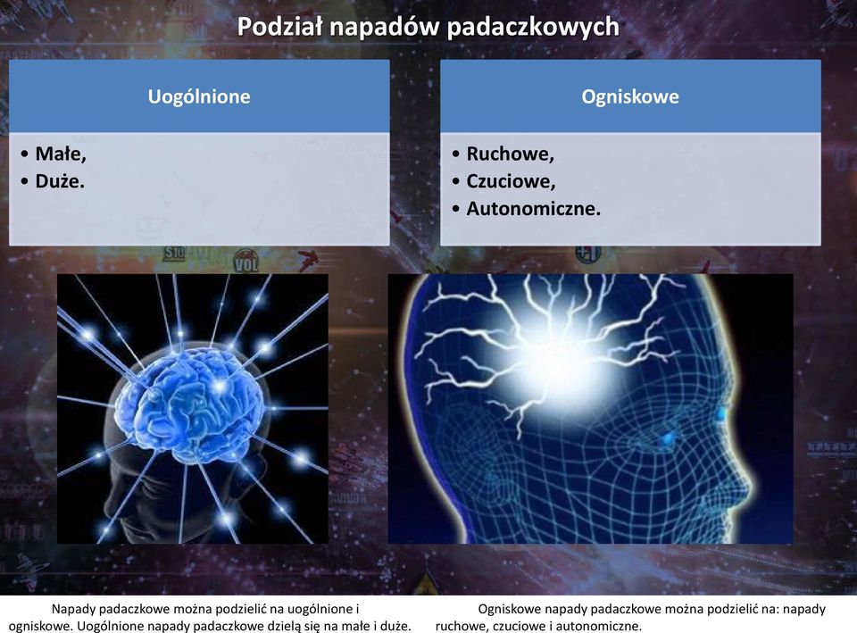 Napady padaczkowe można podzielić na uogólnione i ogniskowe.