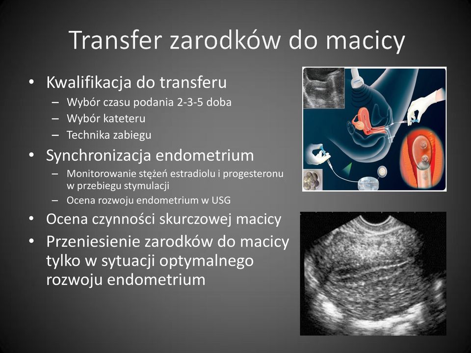 przebiegu stymulacji Ocena rozwoju endometrium w USG Ocena czynności skurczowej