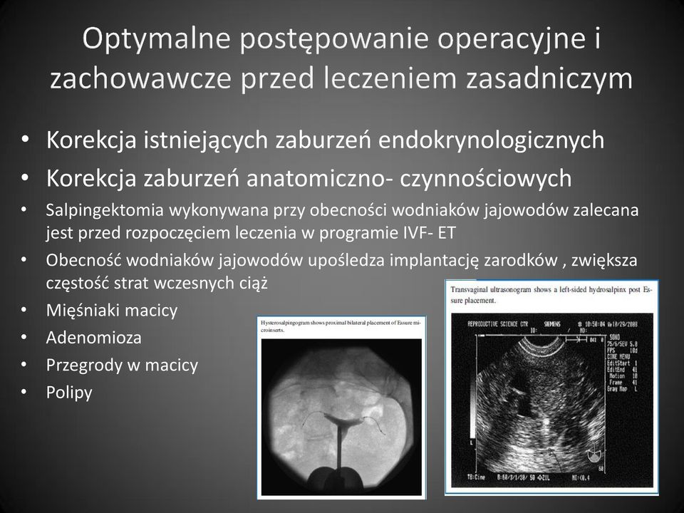 przed rozpoczęciem leczenia w programie IVF- ET Obecność wodniaków jajowodów upośledza