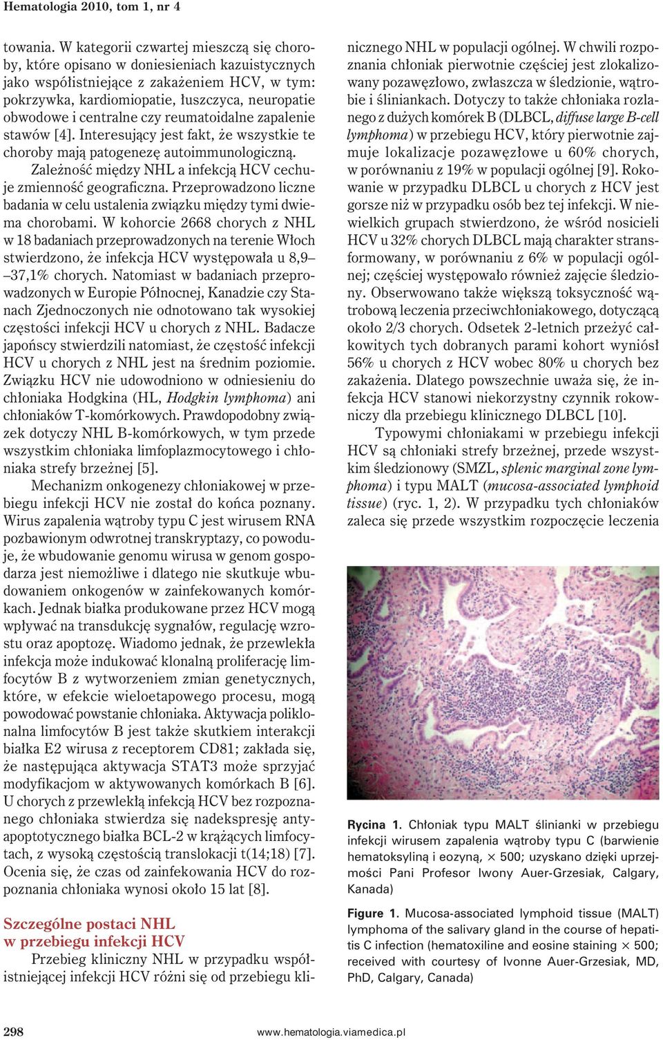 centralne czy reumatoidalne zapalenie stawów [4]. Interesujący jest fakt, że wszystkie te choroby mają patogenezę autoimmunologiczną.