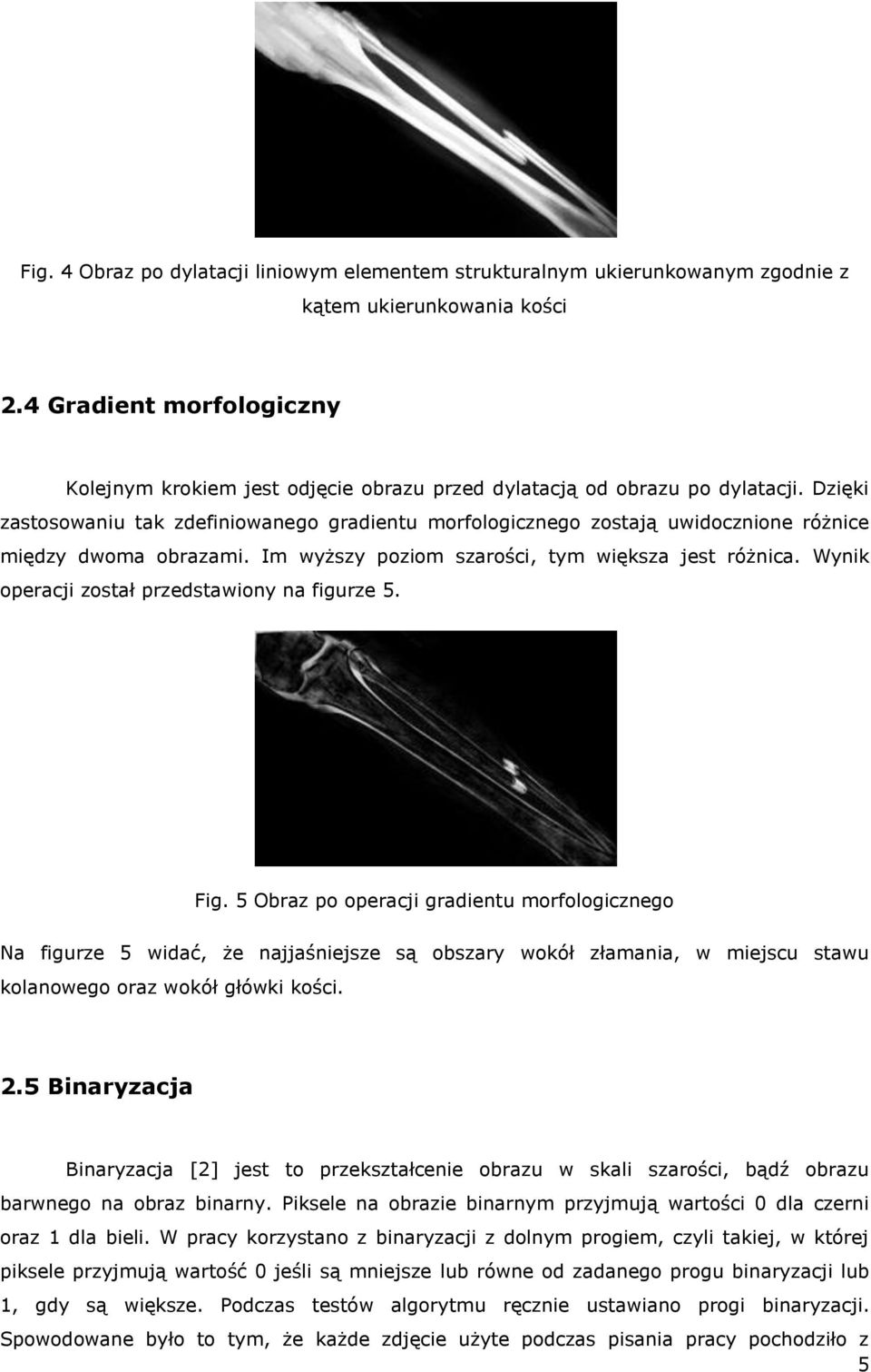 Dzięki zastosowaniu tak zdefiniowanego gradientu morfologicznego zostają uwidocznione różnice między dwoma obrazami. Im wyższy poziom szarości, tym większa jest różnica.