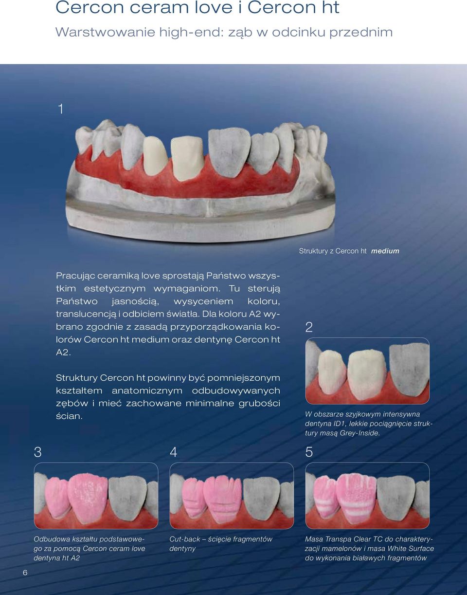 2 Struktury Cercon ht powinny być pomniejszonym kształtem anatomicznym odbudowywanych zębów i mieć zachowane minimalne grubości ścian.