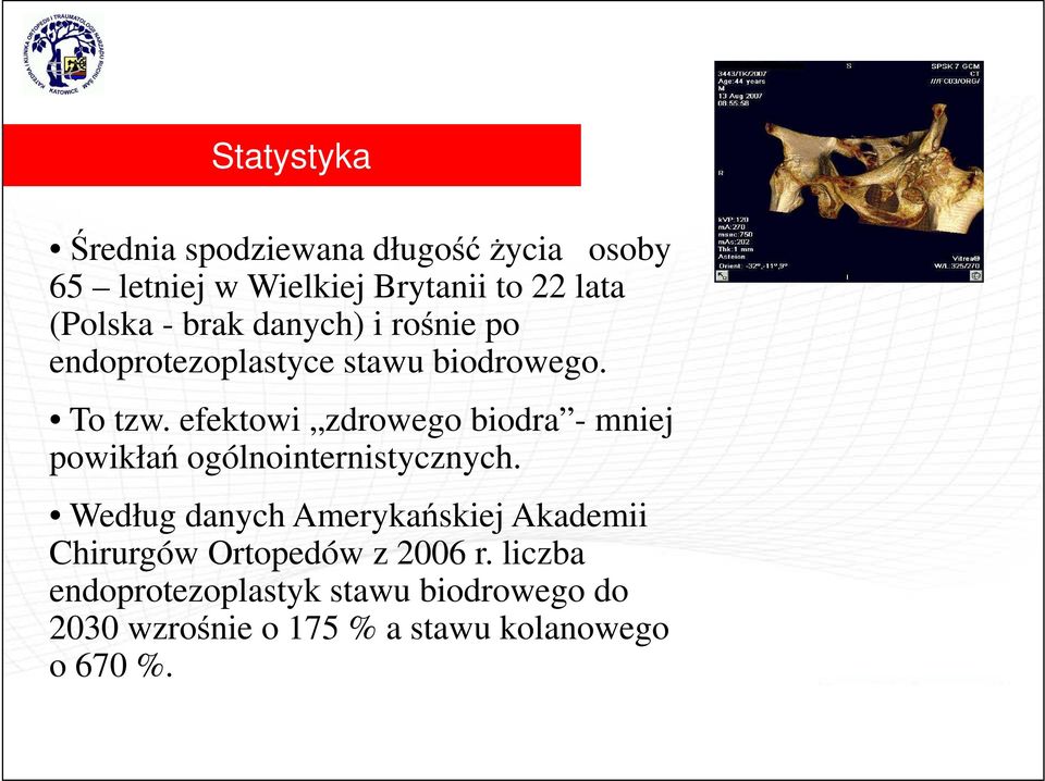 efektowi zdrowego biodra - mniej powikłań ogólnointernistycznych.