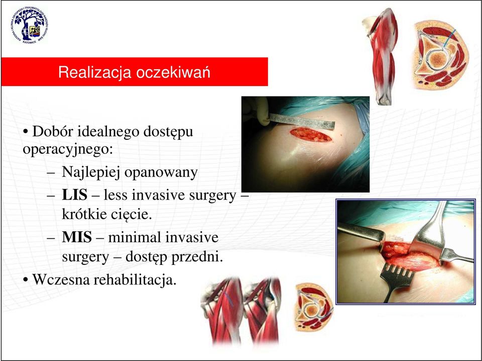 invasive surgery krótkie cięcie.