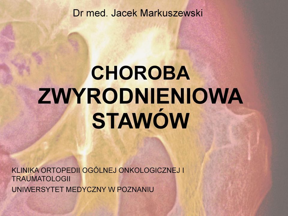 ZWYRODNIENIOWA STAWÓW KLINIKA