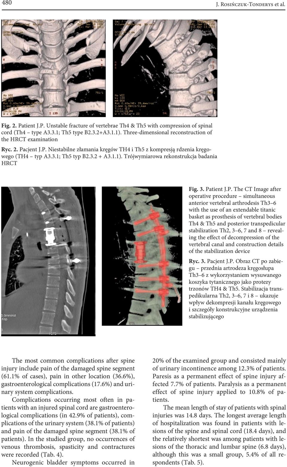 Trójwymiarowa rekonstrukcja badania HRCT Fig. 3. Pa