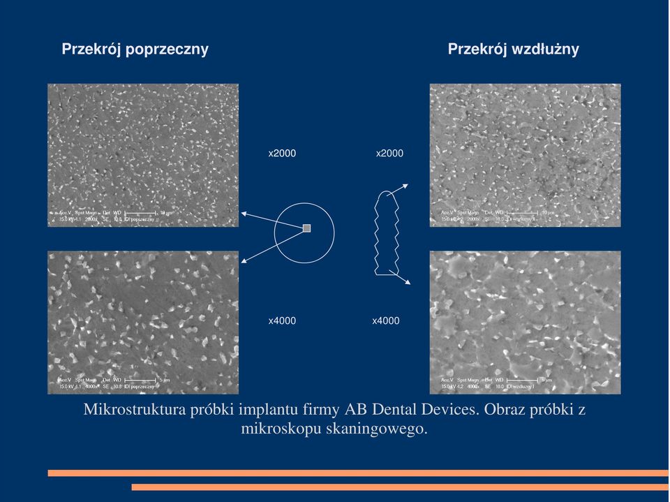 próbki implantu firmy AB Dental Devices.