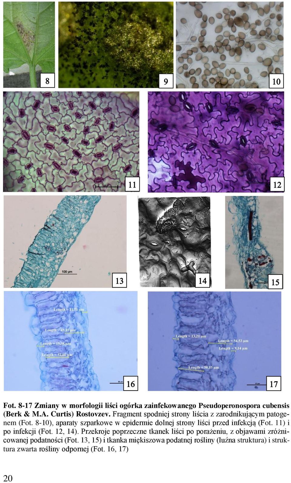 8-10), aparaty szparkowe w epidermie dolnej strony liści przed infekcją (Fot. 11) i po infekcji (Fot. 12, 14).