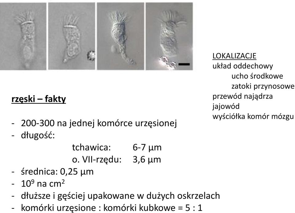 dużych oskrzelach - komórki urzęsione : komórki kubkowe = 5 : 1 LOKALIZACJE układ