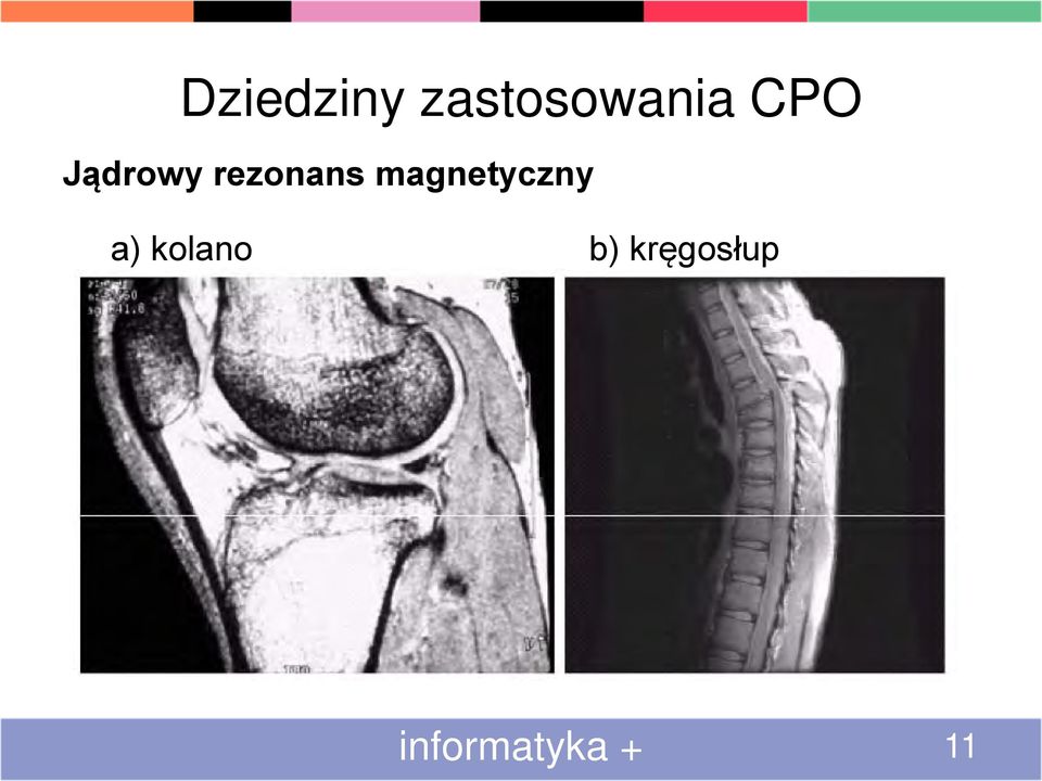 magnetyczny a) kolano