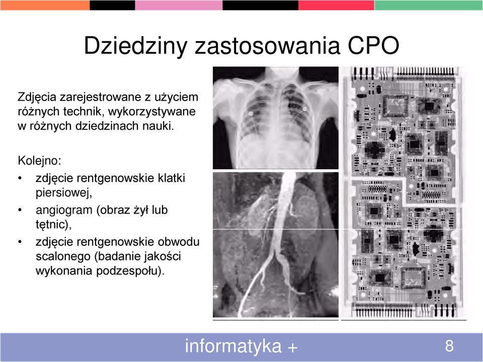 Kolejno: zdjęcie rentgenowskie klatki piersiowej, angiogram (obraz żył lub