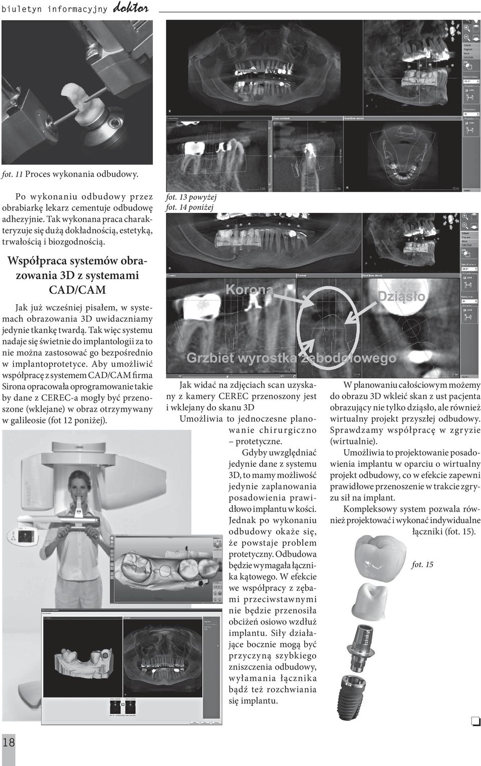 Współpraca systemów obrazowania 3D z systemami CAD/CAM Jak już wcześniej pisałem, w systemach obrazowania 3D uwidaczniamy jedynie tkankę twardą.