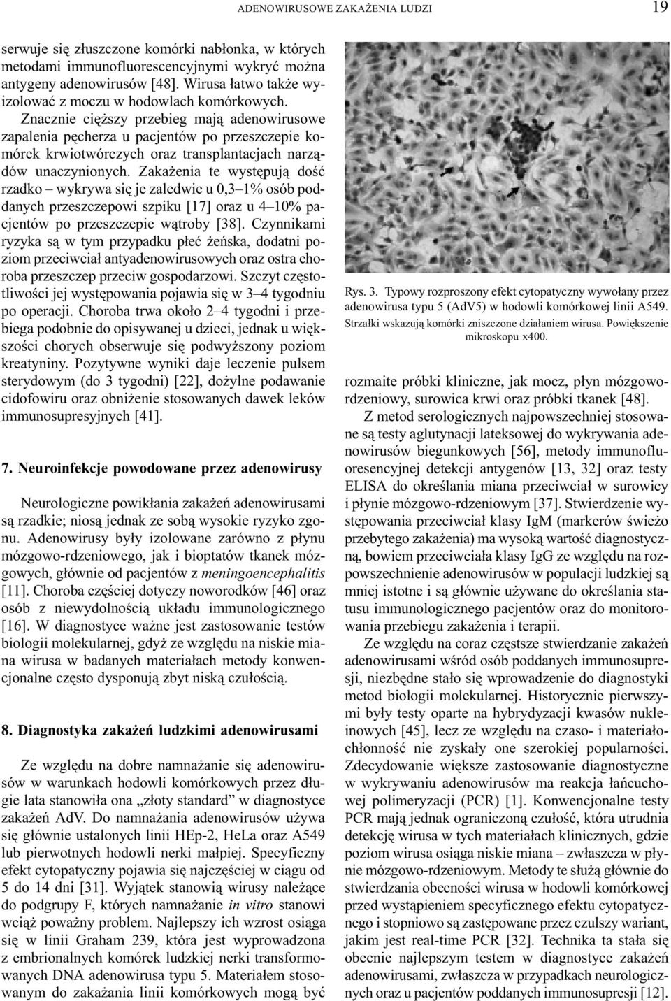 Znacznie ciê szy przebieg maj¹ adenowirusowe zapalenia pêcherza u pacjentów po przeszczepie komórek krwiotwórczych oraz transplantacjach narz¹dów unaczynionych.