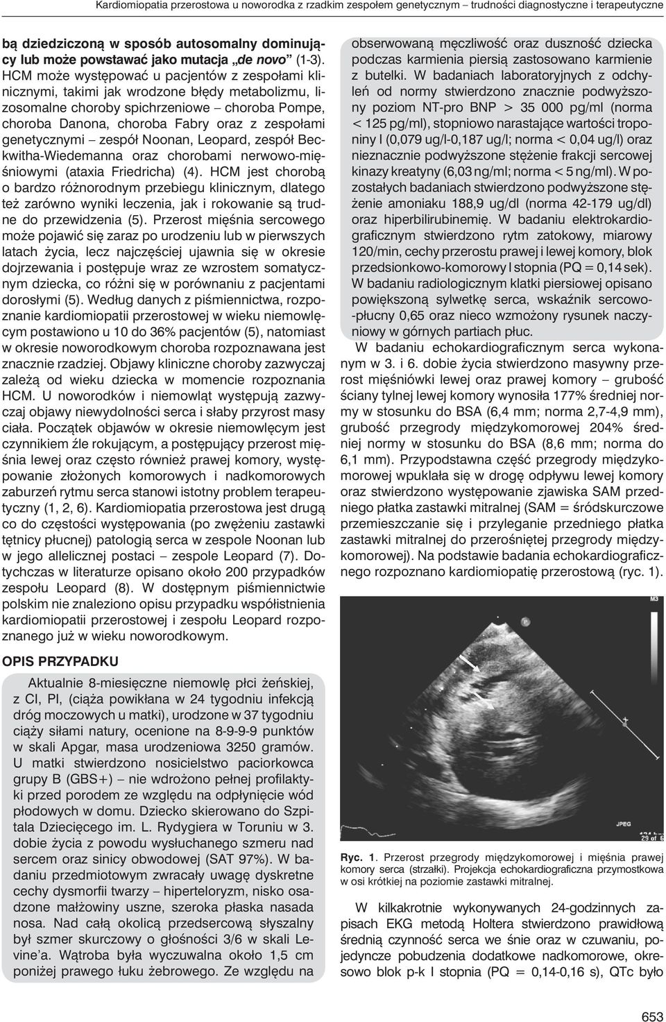 HCM może występować u pacjentów z zespołami klinicznymi, takimi jak wrodzone błędy metabolizmu, lizosomalne choroby spichrzeniowe choroba Pompe, choroba Danona, choroba Fabry oraz z zespołami