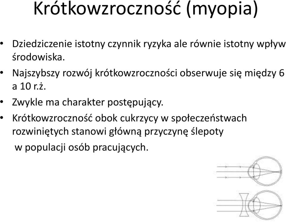 Najszybszy rozwój krótkowzroczności obserwuje się między 6 a 10 r.ż.