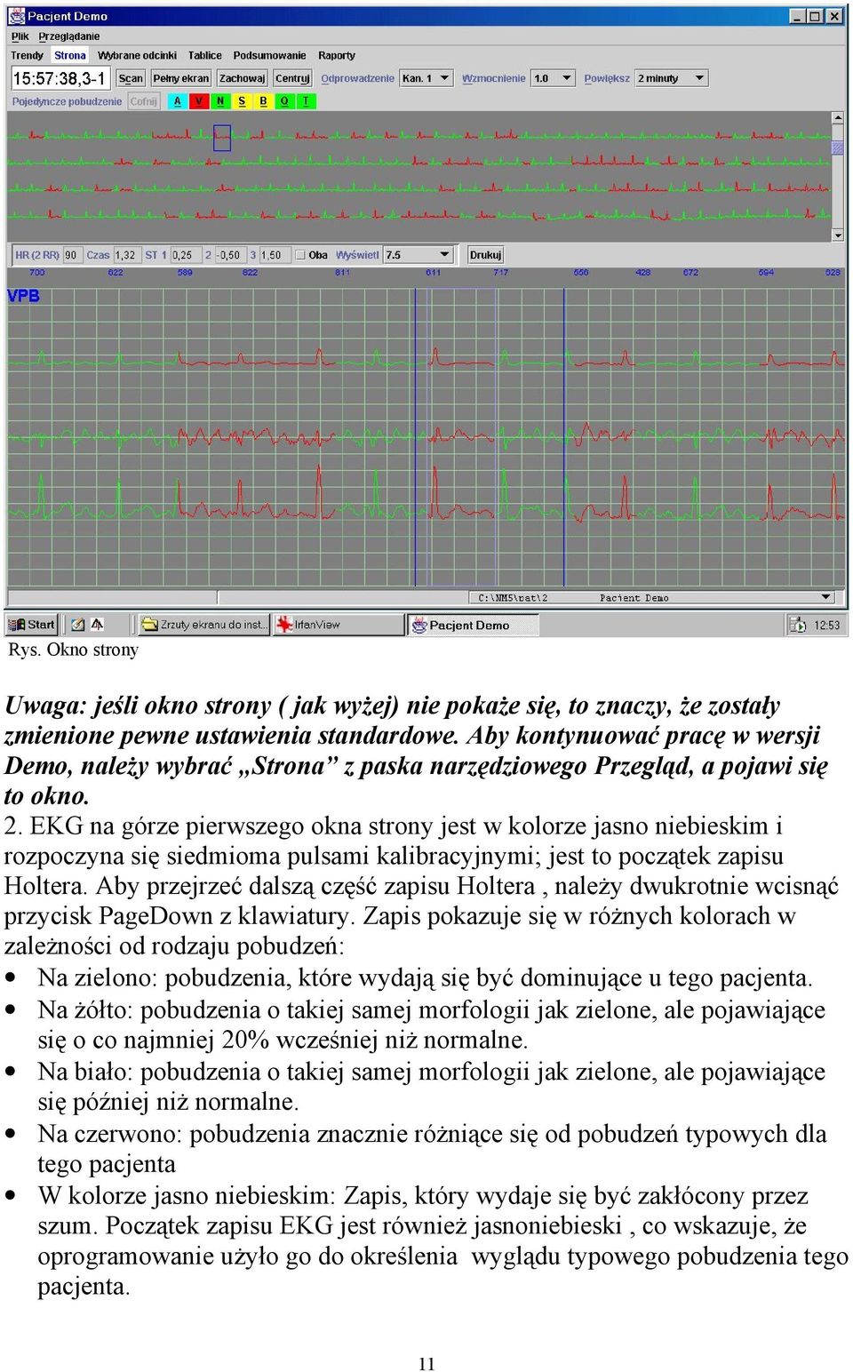 EKG na górze pierwszego okna strony jest w kolorze jasno niebieskim i rozpoczyna się siedmioma pulsami kalibracyjnymi; jest to początek zapisu Holtera.