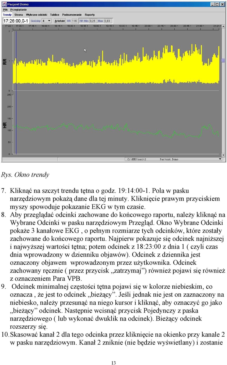 Okno Wybrane Odcinki pokaże 3 kanałowe EKG, o pełnym rozmiarze tych odcinków, które zostały zachowane do końcowego raportu.