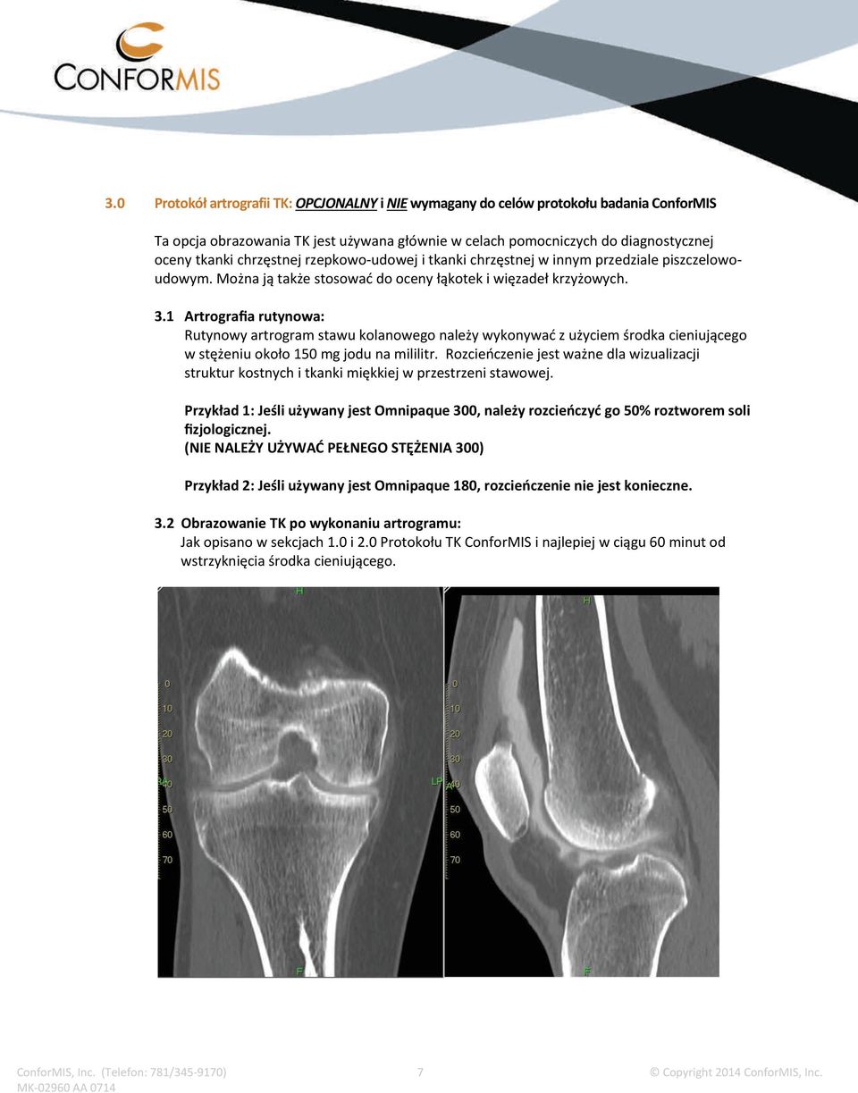 1 Artrografia rutynowa: Rutynowy artrogram stawu kolanowego należy wykonywać z użyciem środka cieniującego w stężeniu około 150 mg jodu na mililitr.