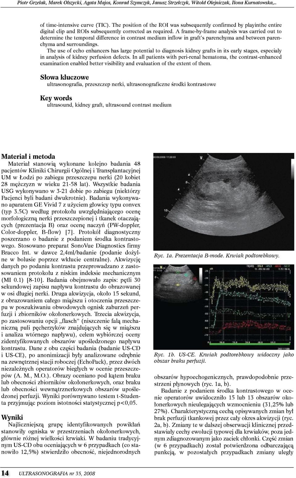 a frame-by-frame analysis was carried out to determine the temporal difference in contrast medium inflow in graft s parenchyma and between parenchyma and surroundings.