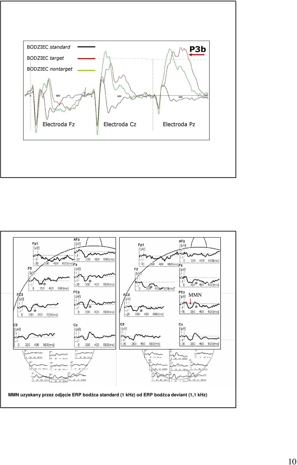 Electroda Pz * * * * MMN * * * * MMN uzyskany