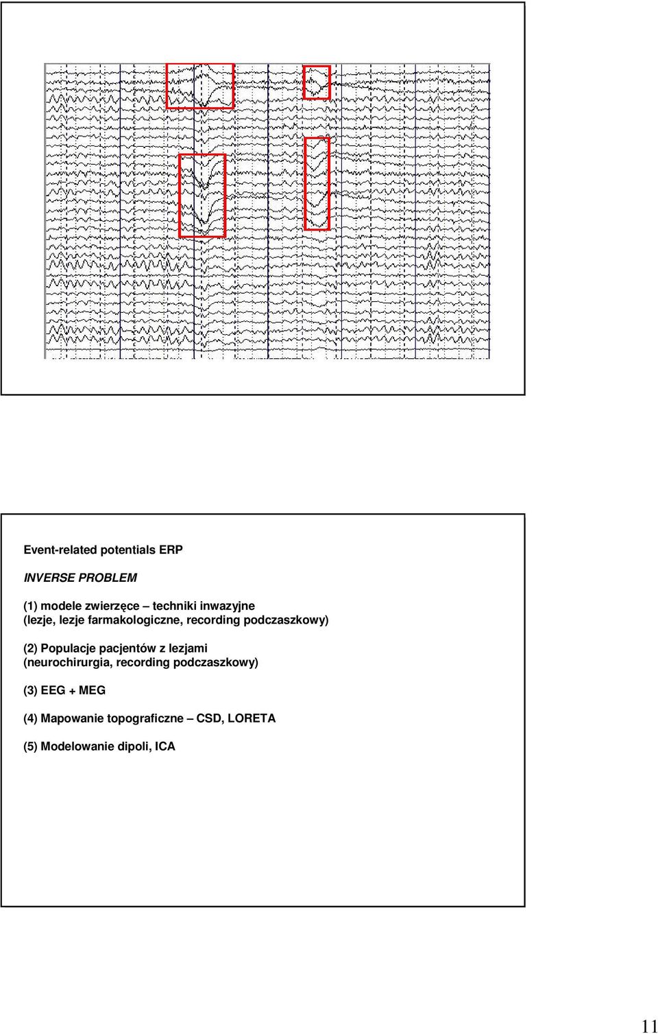 Populacje pacjentów z lezjami (neurochirurgia, recording podczaszkowy) (3)