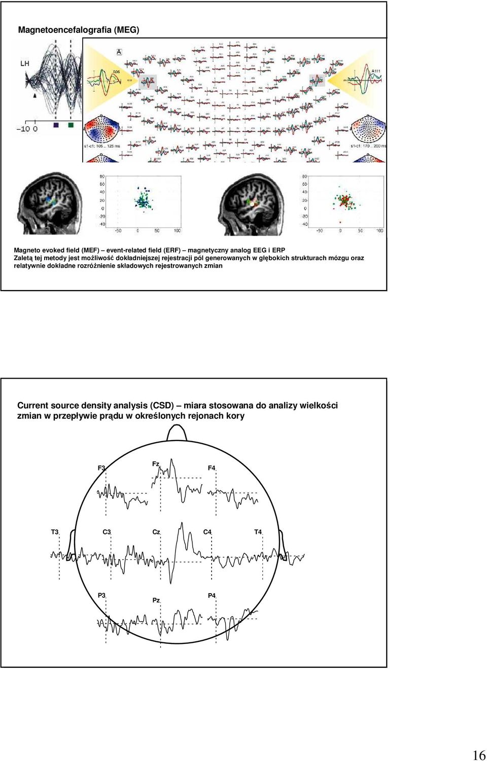 relatywnie dokładne rozróŝnienie składowych rejestrowanych zmian Current source density analysis (CSD) miara