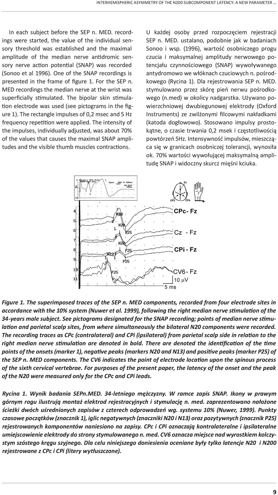 (Sonoo et al 1996). One of the SNAP recordings is presented in the frame of figure 1. For the SEP n. MED recordings the median nerve at the wrist was superficially stimulated.