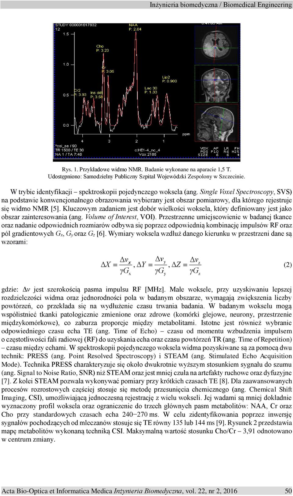 Single Voxel Spectroscopy, SVS) na podstawie konwencjonalnego obrazowania wybierany jest obszar pomiarowy, dla którego rejestruje się widmo NMR [5].