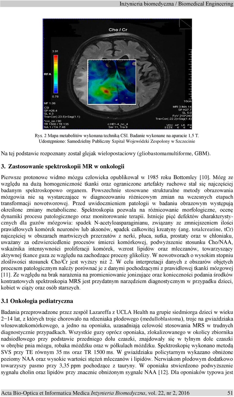 Zastosowanie spektroskopii MR w onkologii Pierwsze protonowe widmo mózgu człowieka opublikował w 1985 roku Bottomley [10].