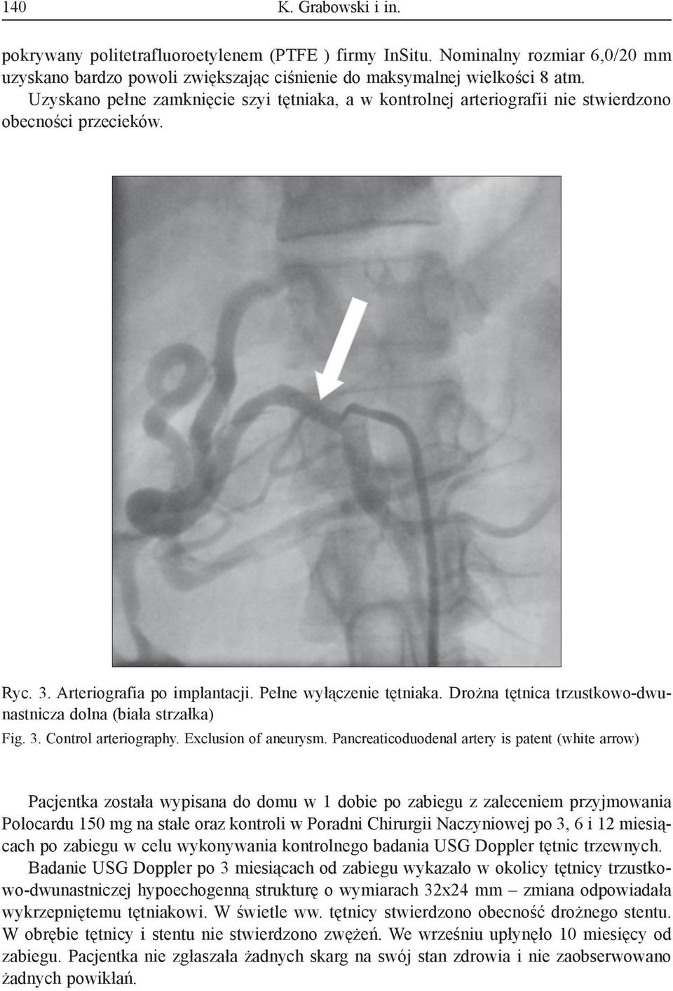 Drożna tętnica trzustkowo-dwunastnicza dolna (biała strzałka) Fig. 3. Control arteriography. Exclusion of aneurysm.