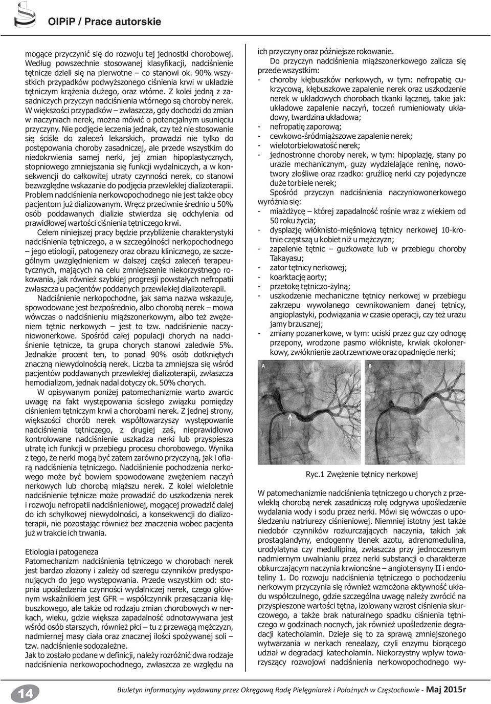 Niemniej istotny jest także niedobór czynników rozkurczających naczynia, takich jak prostaglandyny, endogenny tlenek azotu, adrenomedulina, urodylatyna czy medullipina, zwłaszcza przy jednoczesnym