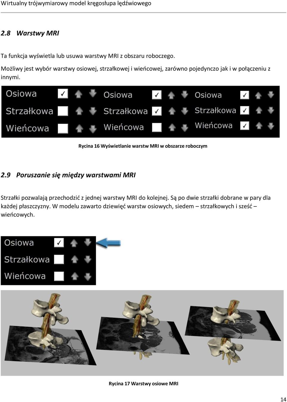 Rycina 16 Wyświetlanie warstw MRI w obszarze roboczym 2.