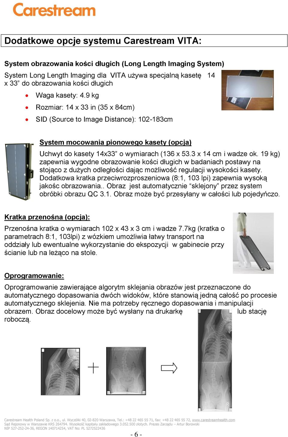 3 x 14 cm i wadze ok. 19 kg) zapewnia wygodne obrazowanie kości długich w badaniach postawy na stojąco z dużych odległości dając możliwość regulacji wysokości kasety.