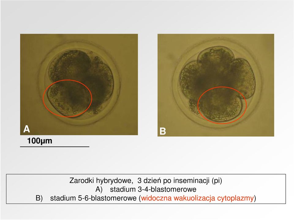 3-4-blastomerowe B) stadium