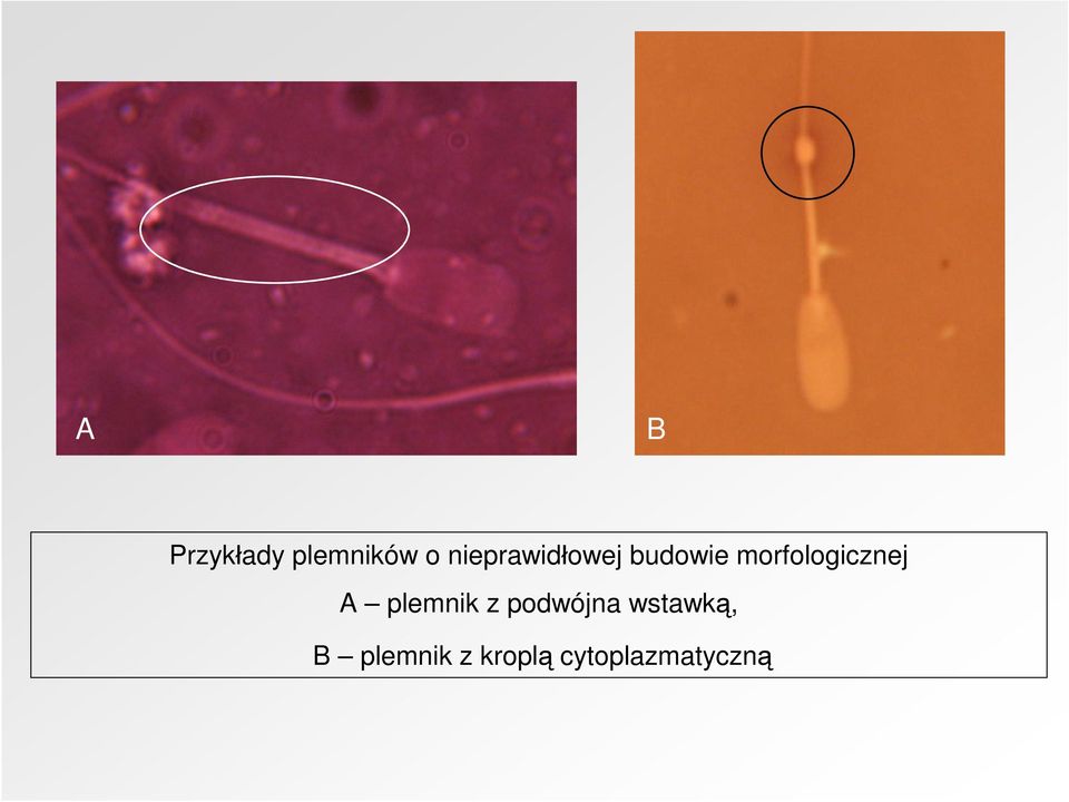 morfologicznej A plemnik z