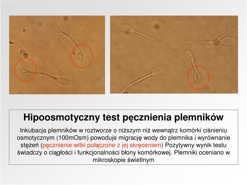 wyrównanie stężeń (pęcznienie witki połączone z jej skręceniem) Pozytywny wynik testu